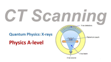 X-Rays - CT Scanning